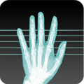 X-RayScanner