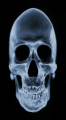 XRay