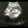 Full Term - Contraction Timer APK